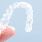 Invisalign Dental Office Charlotte