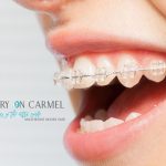 invisalign-provider-south-charlotte