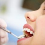 dental-cleaning-dentist-charlotte