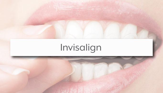 Invisalign Provider South Charlotte Dental Office M. Katy Moore DMD