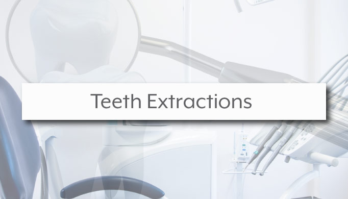 teeth extractions charlotte